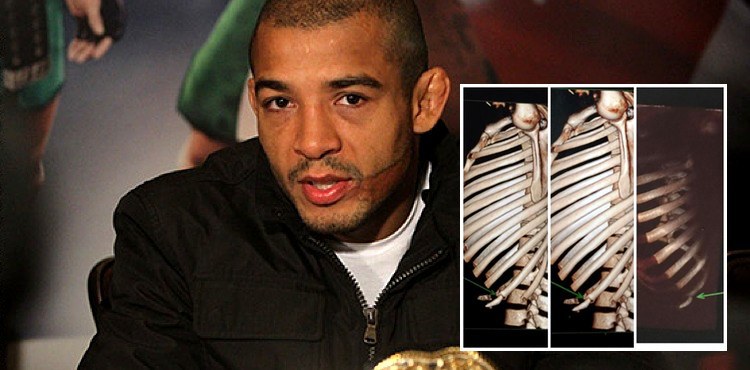 Jose-Aldo-Rib-X-Rays-750